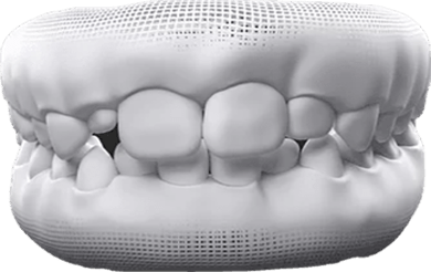 Adult & Baby Teeth Mixed
