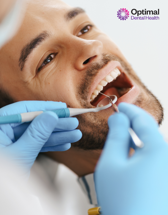 smart-almagram-removal