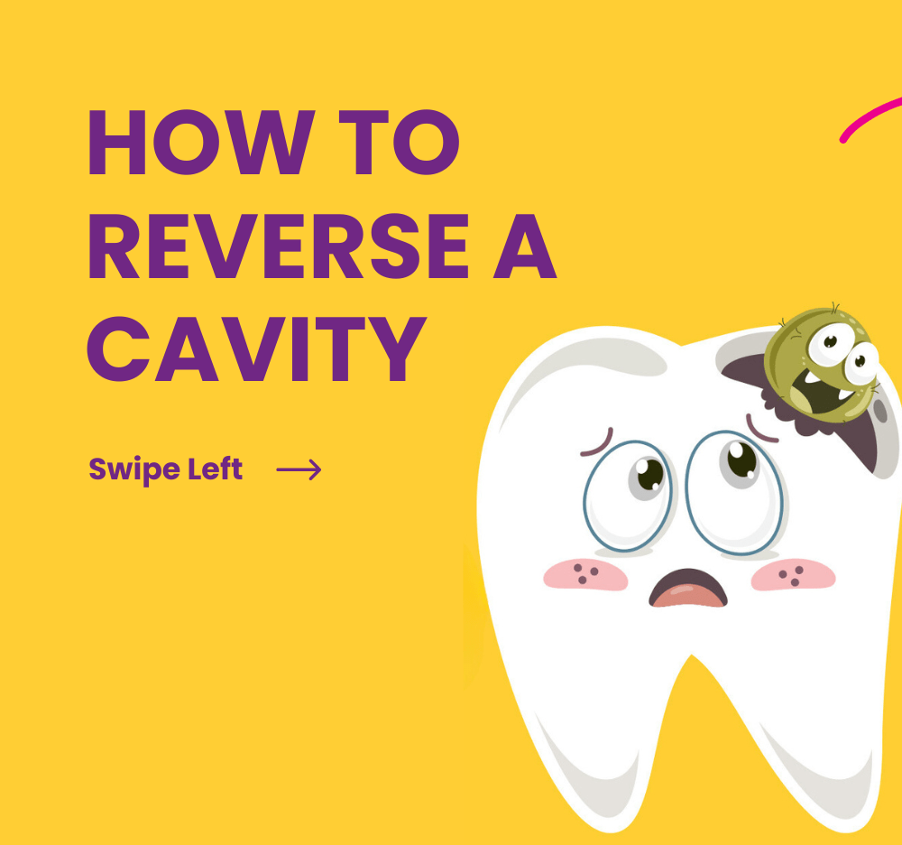 prevent cavities