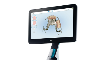 itero lumina scanner